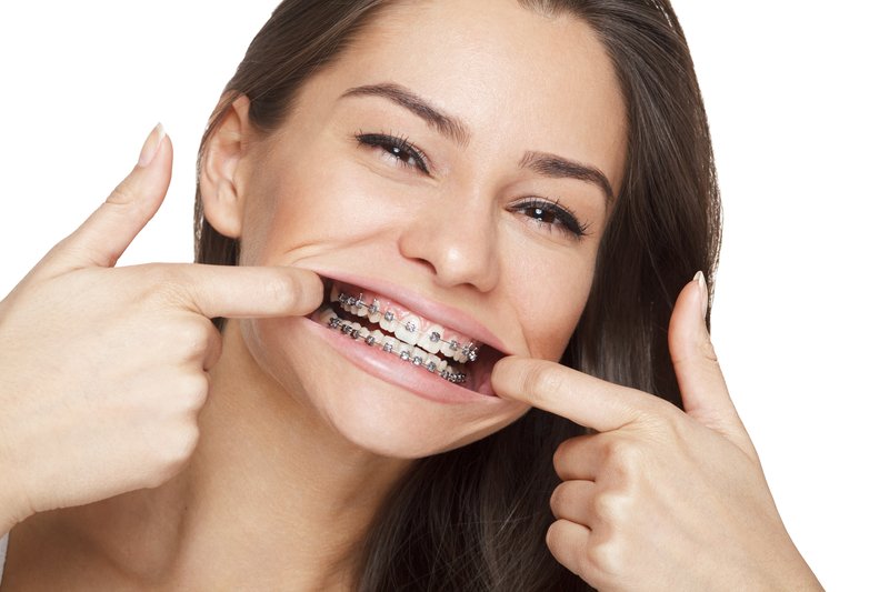 Happy patient smiling after braces treatment